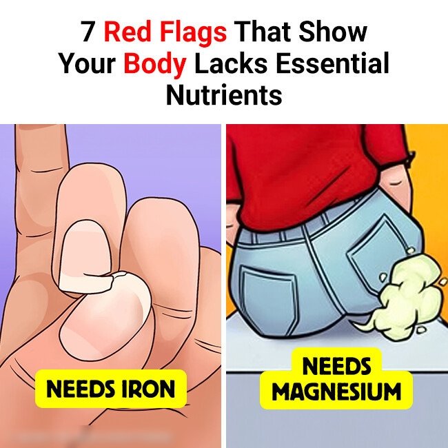 7 Red Flags That Show Your Body Lacks Essential Nutrients…