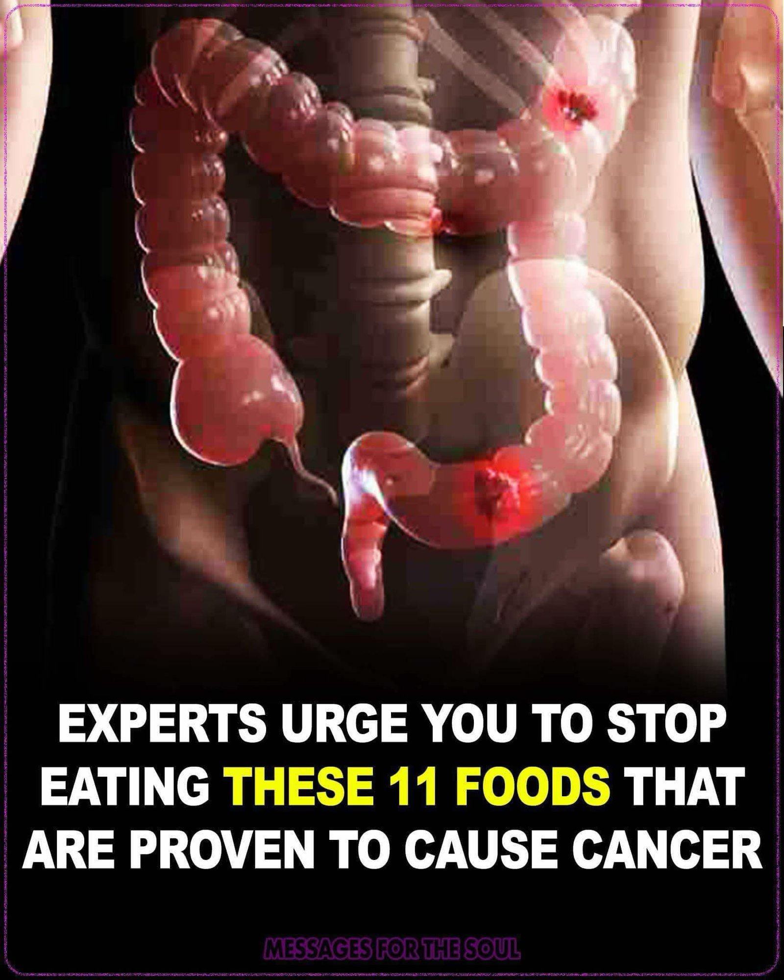 15 Cancer Causing Foods You Need to Avoid