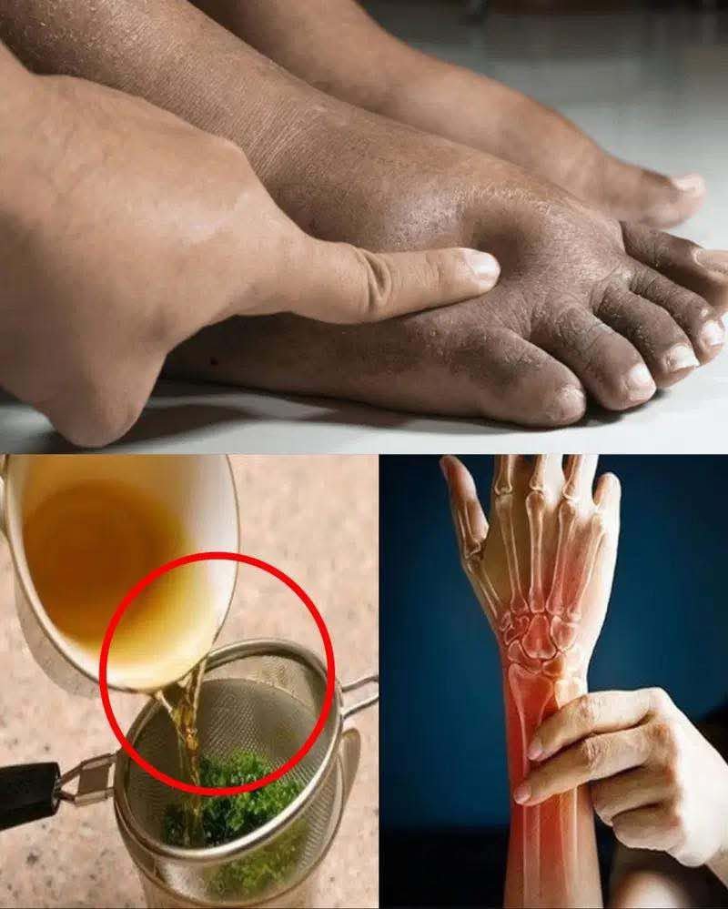 Simple and quick home remedies for swollen feet…