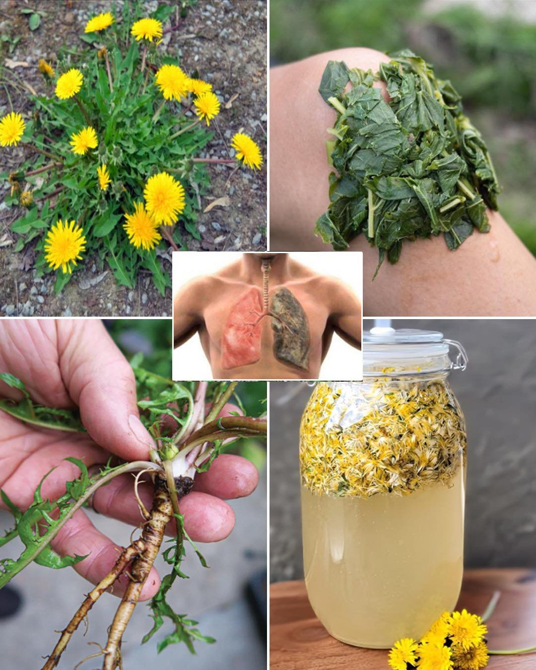 5 Health Benefits and Uses of Dandelion