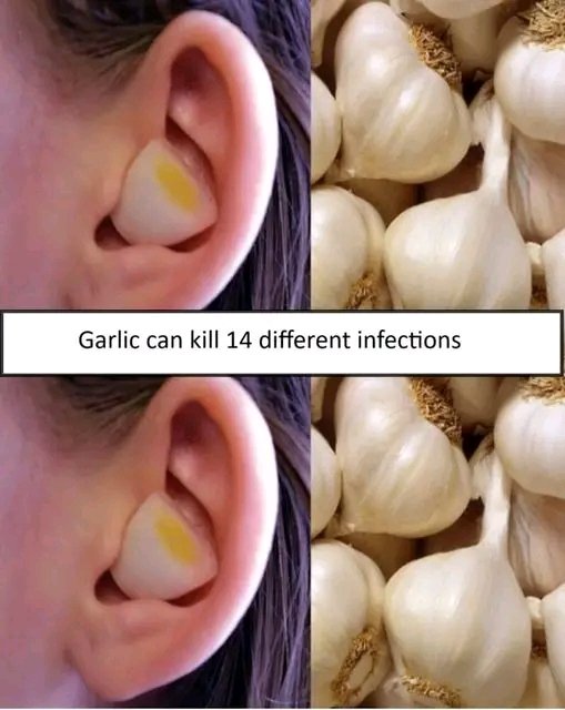 Garlic Can Kill 14 Different Infections – I Bet You Didn’t Know This!