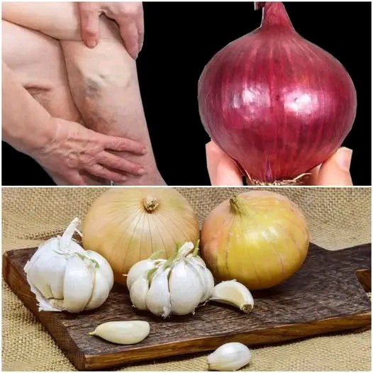 Mom’s Natural Remedy: Onion for Pain Relief and Joint Health