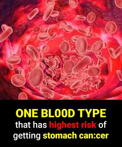 If you have a certain blood type, you’re MORE likely to develop cancer, research suggests
